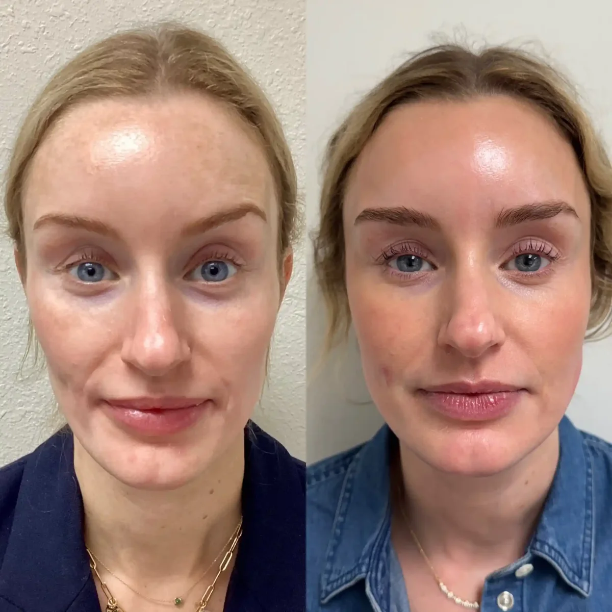 EZ Gel_Regenerative-Pure Skin and Aesthetics in-Stillwater-OK