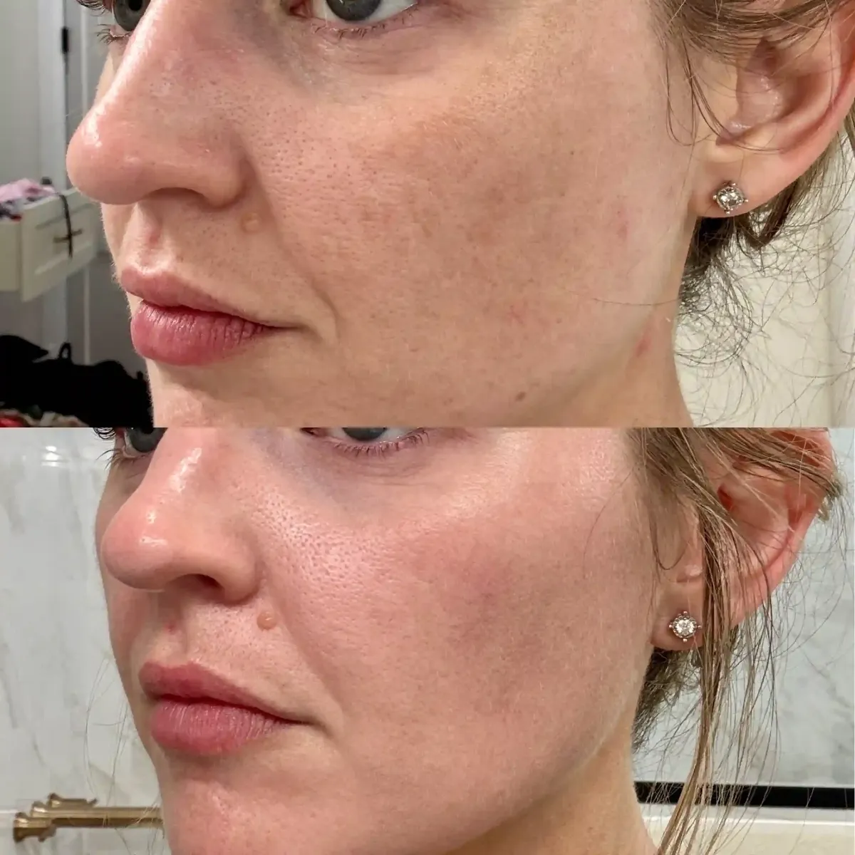 Skin A-Pure Skin and Aesthetics in-Stillwater-OK