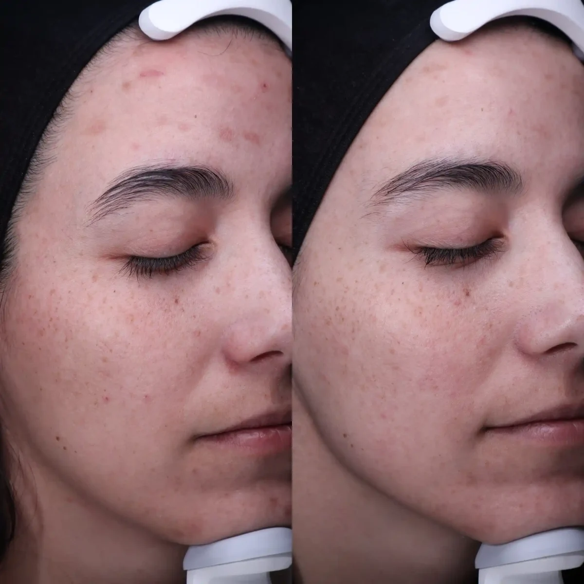 Skin D-Pure Skin and Aesthetics in-Stillwater-OK