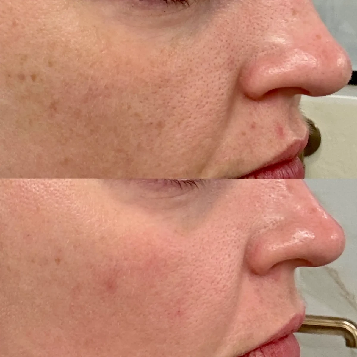 Skin E-Pure Skin and Aesthetics in-Stillwater-OK