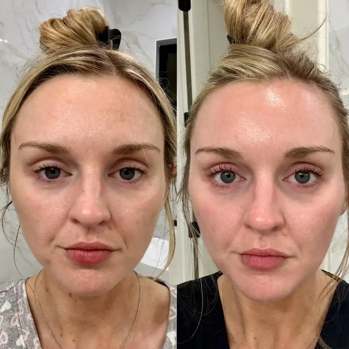 Skin F-Pure Skin and Aesthetics in-Stillwater-OK
