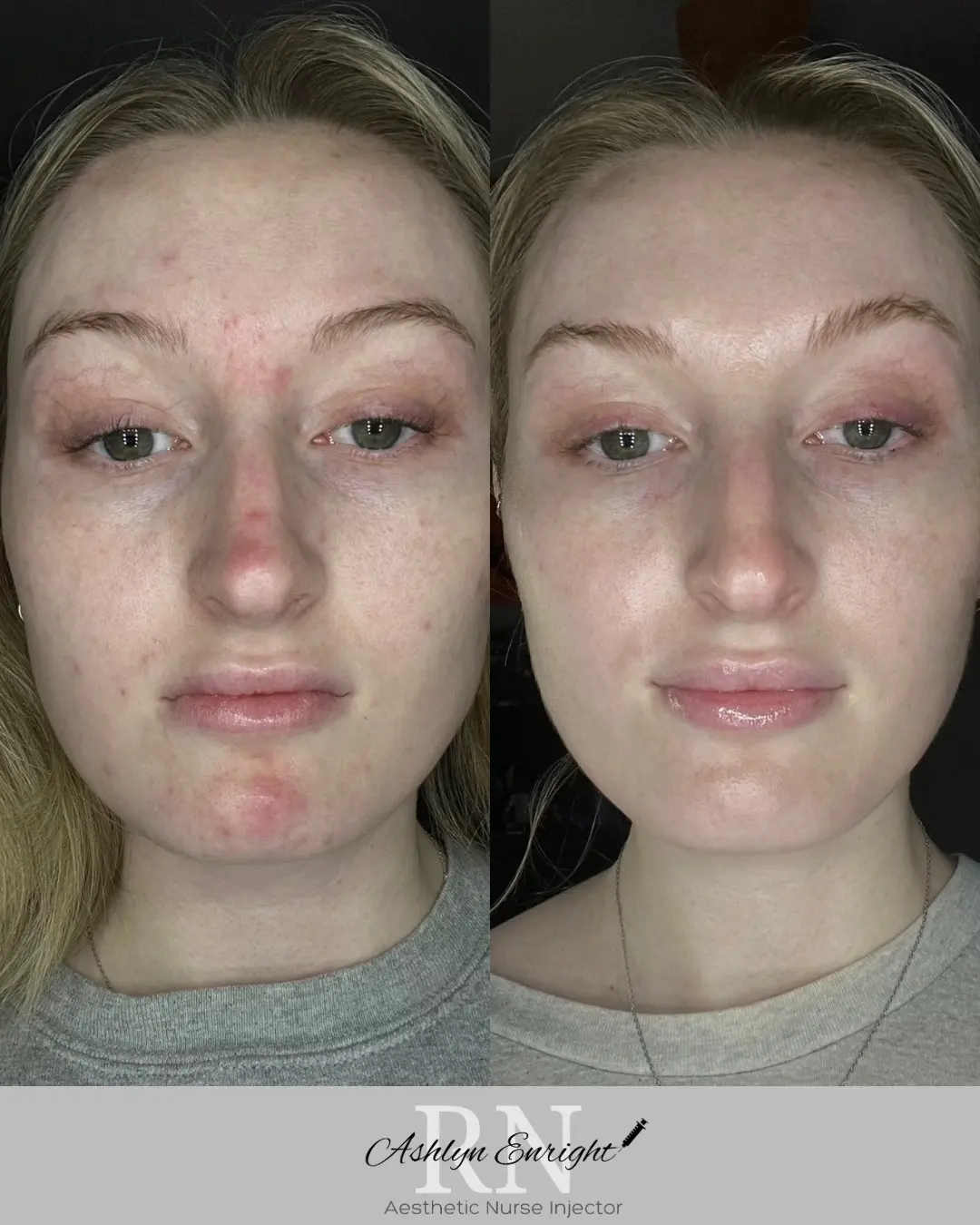 Skin k-Pure Skin and Aesthetics in-Stillwater-OK