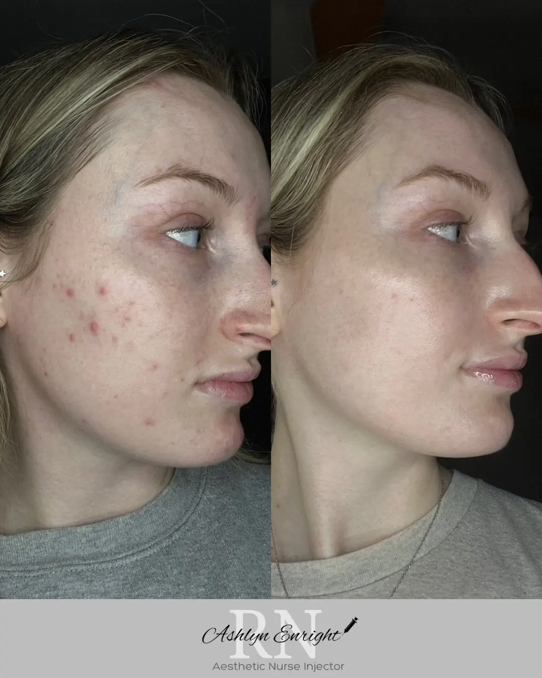 Skin l-Pure Skin and Aesthetics in-Stillwater-OK