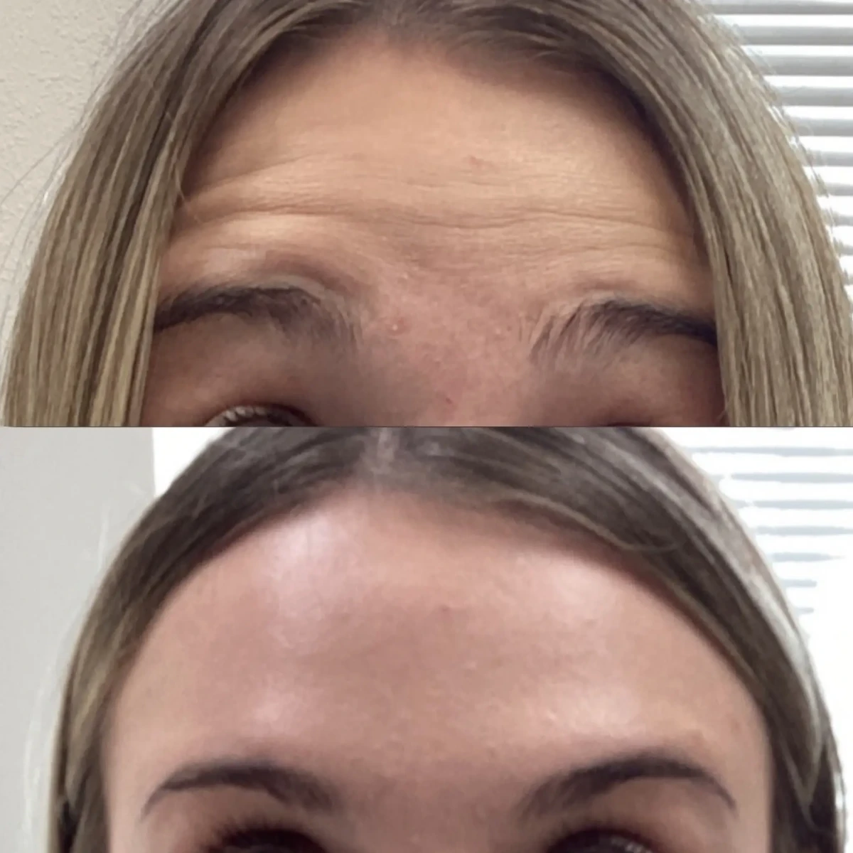 Wrinkle Relaxers A-Pure Skin and Aesthetics in-Stillwater-OK