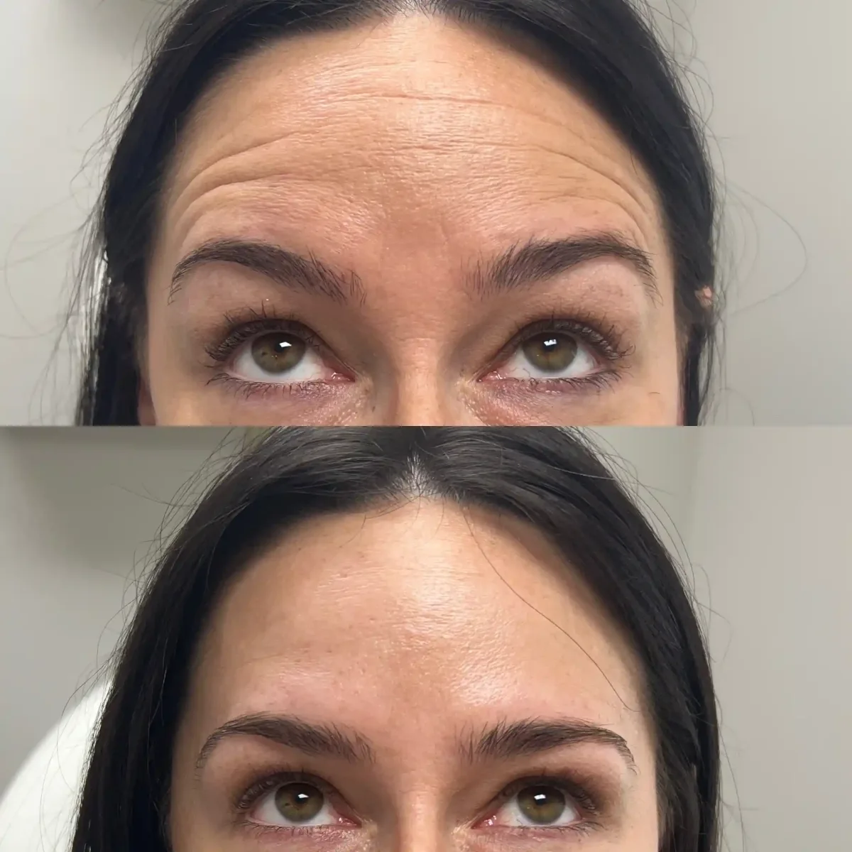 Wrinkle Relaxers Q-Pure Skin and Aesthetics in-Stillwater-OK