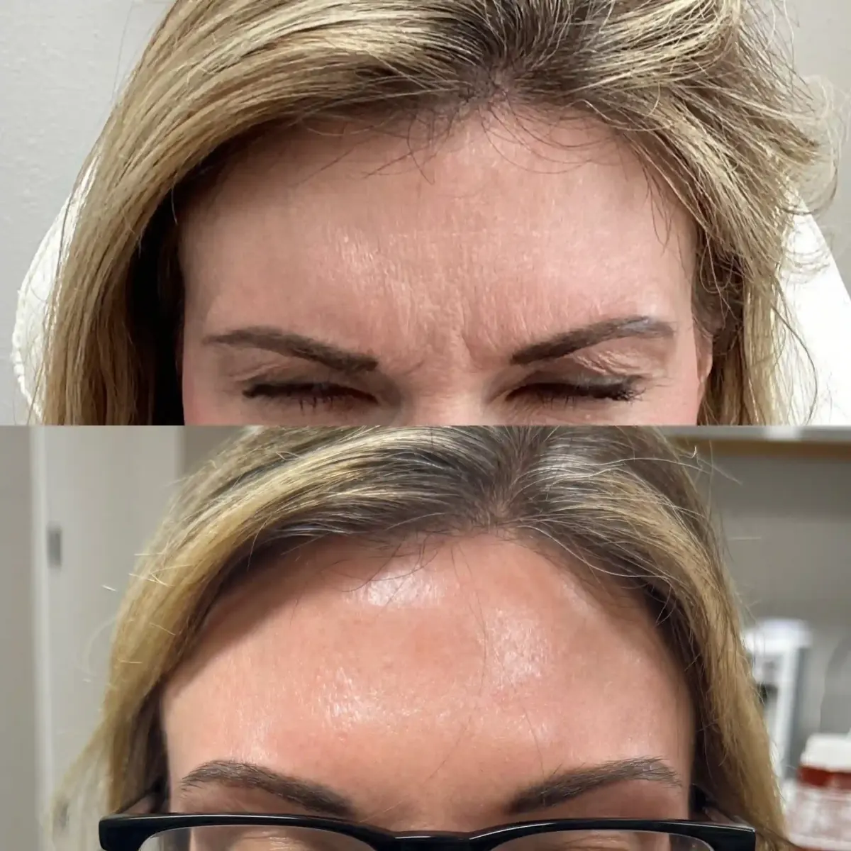 Wrinkle Relaxers k-Pure Skin and Aesthetics in-Stillwater-OK