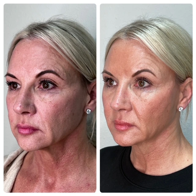 Pure Skin and AestheticsTHREADS hin-Stillwater-OK
