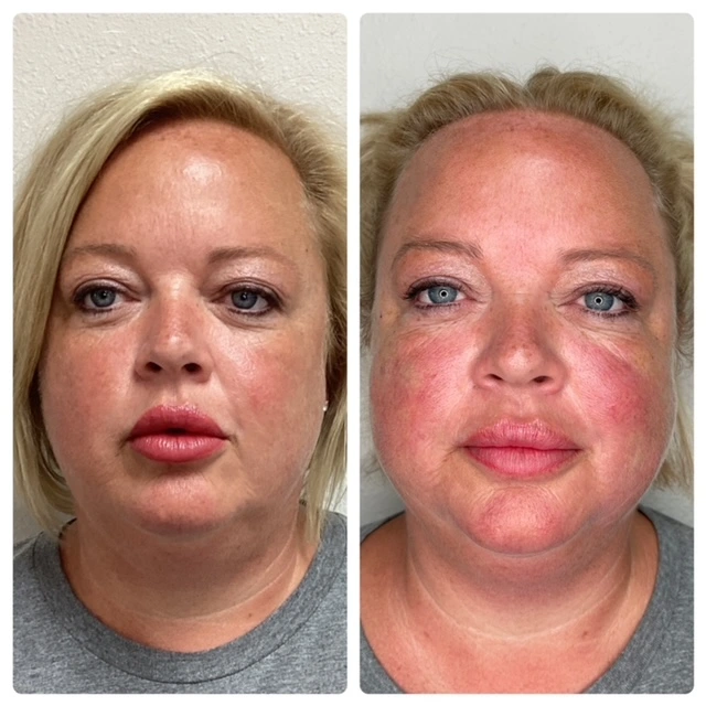 Pure Skin and AestheticsTHREADS iin-Stillwater-OK